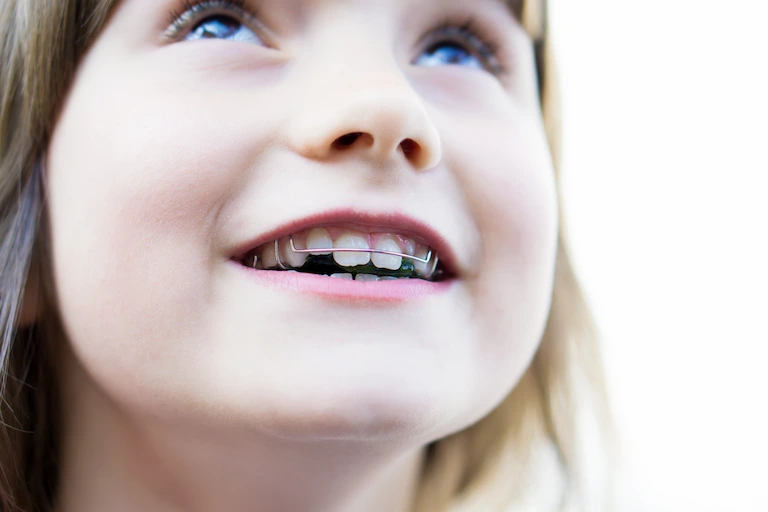 Kind mit Zahnspange - Retainer